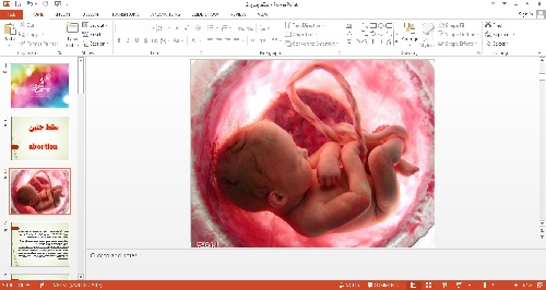 پاورپوینت سقط جنین (پزشکی قانونی )