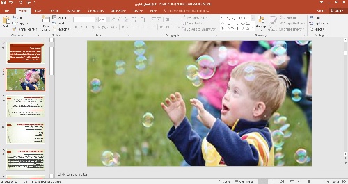 پاورپوینت سندروم داون 